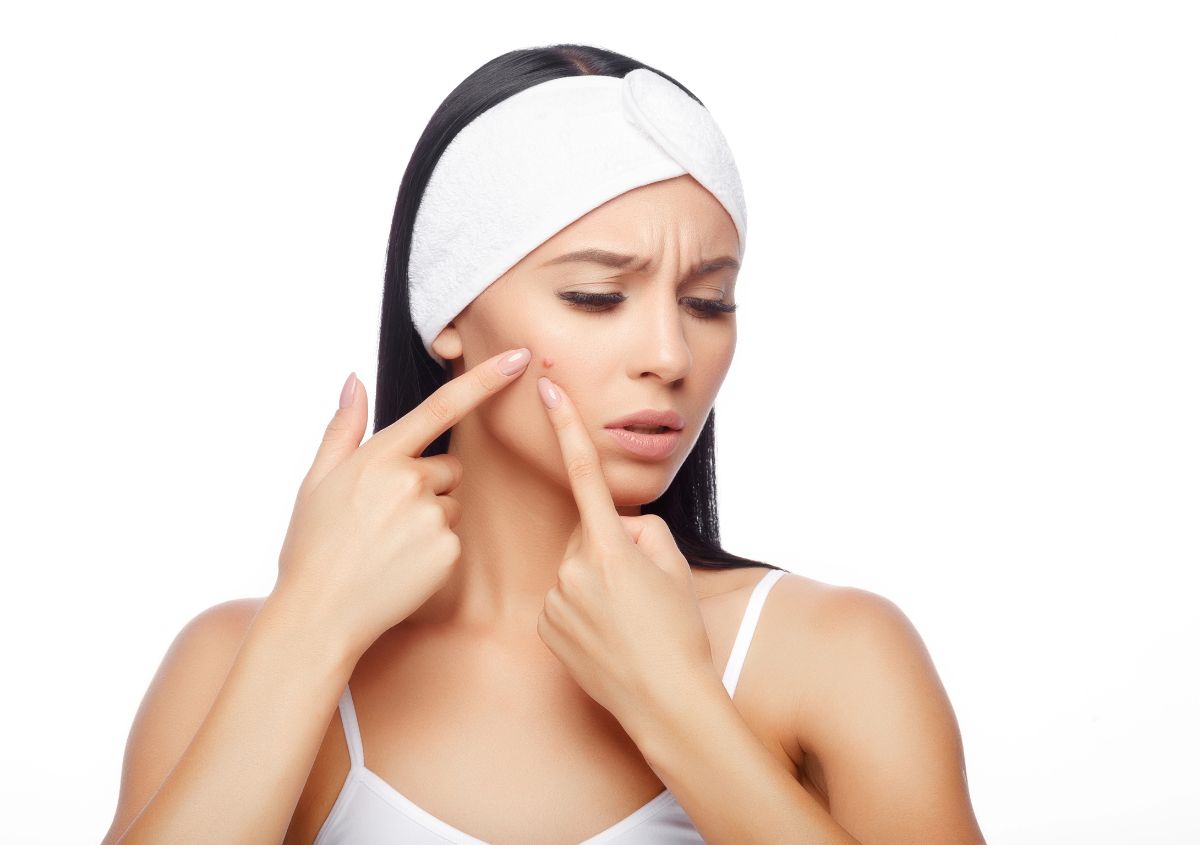 Say Goodbye to Breakouts: 6 Common Pimple Mistakes a Dermatologist Can Help You Avoid