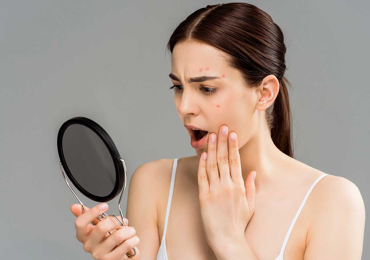 Understanding Hormonal Pimples: Your Guide to Treatment at Melanie L. Adams, M.D., P.A. Dermatology in Columbia, MD 